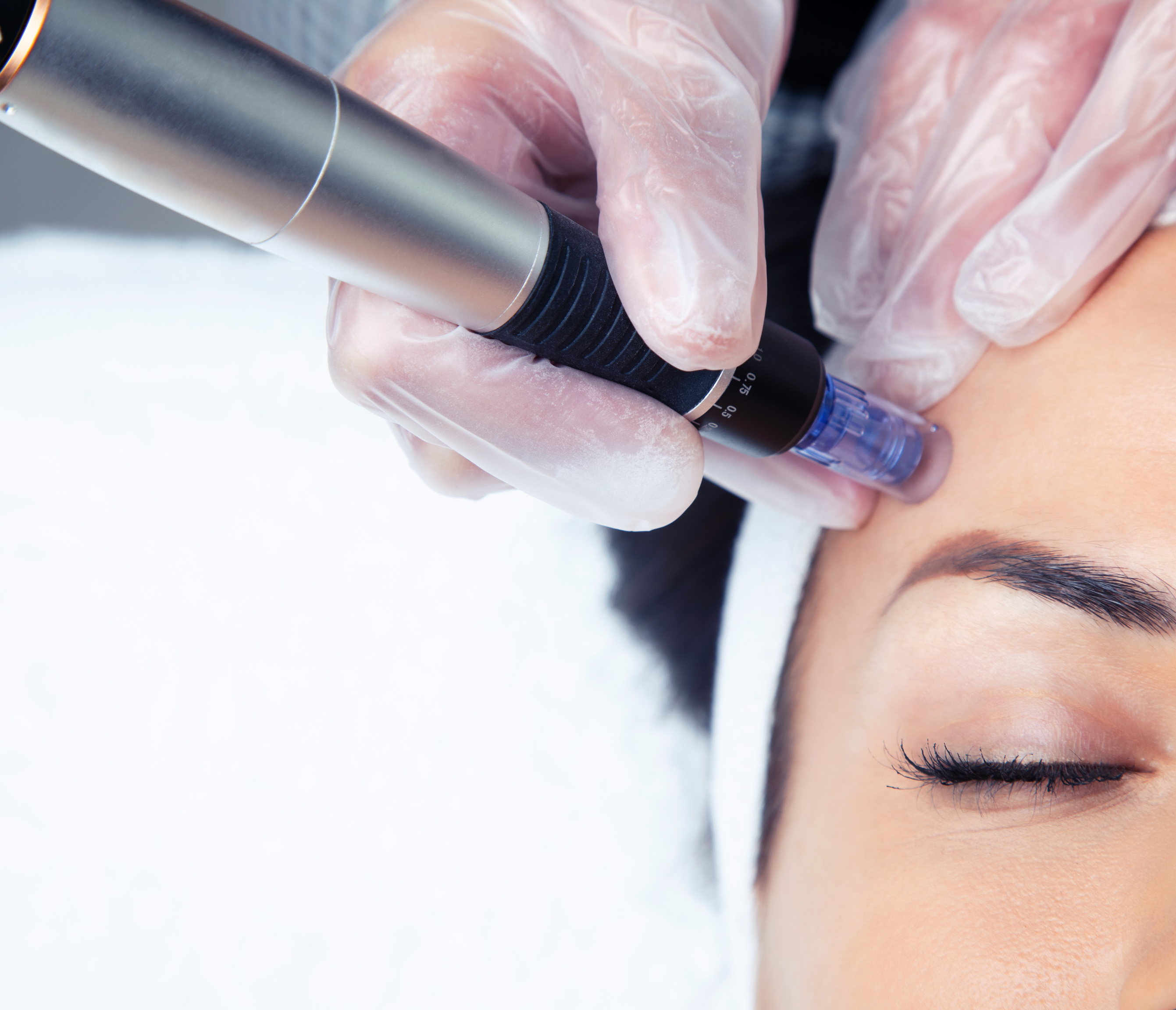 Microneedle