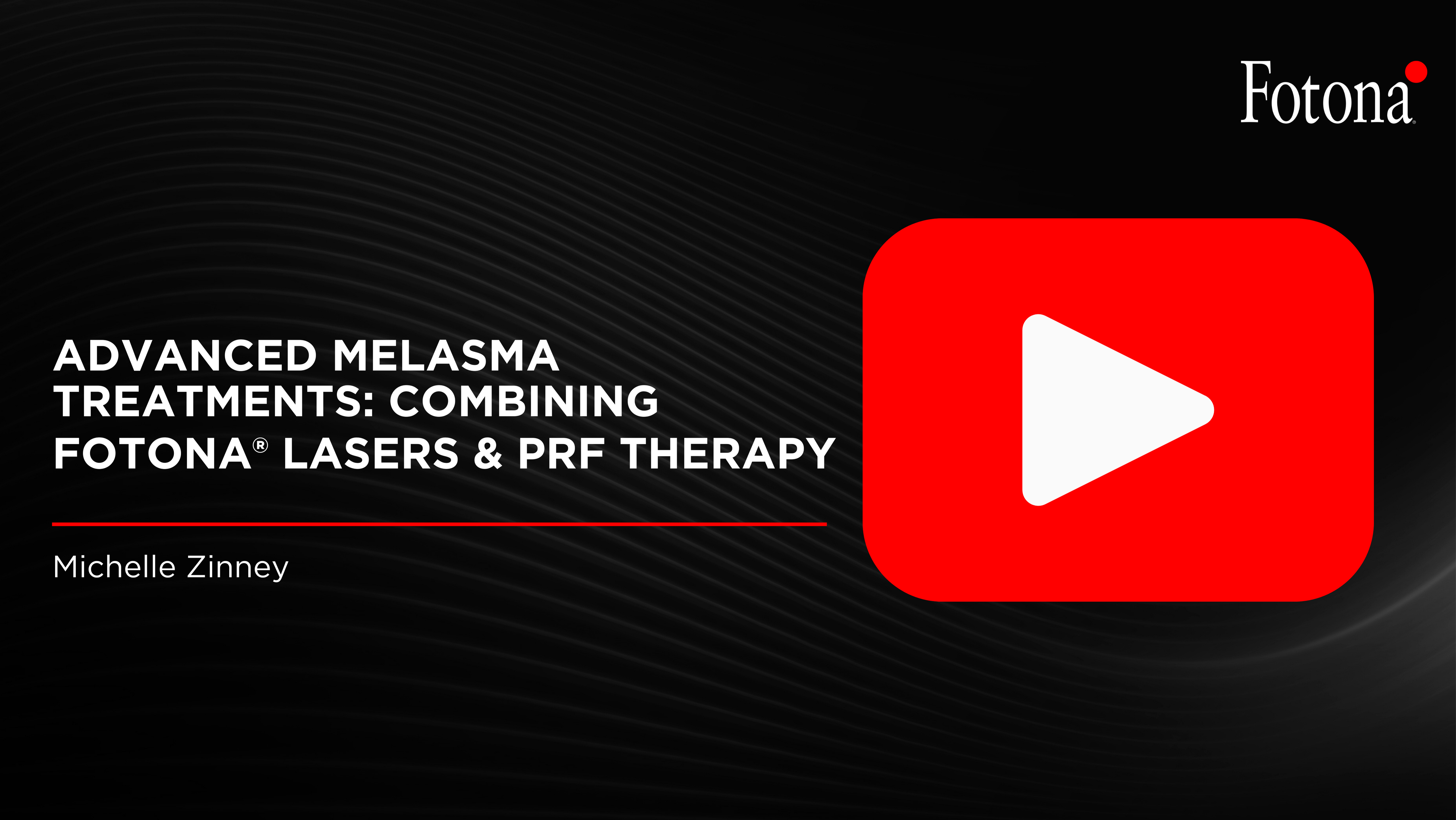 Advanced Melasma Treatments: Combining Fotona® Lasers and PRF Therapy