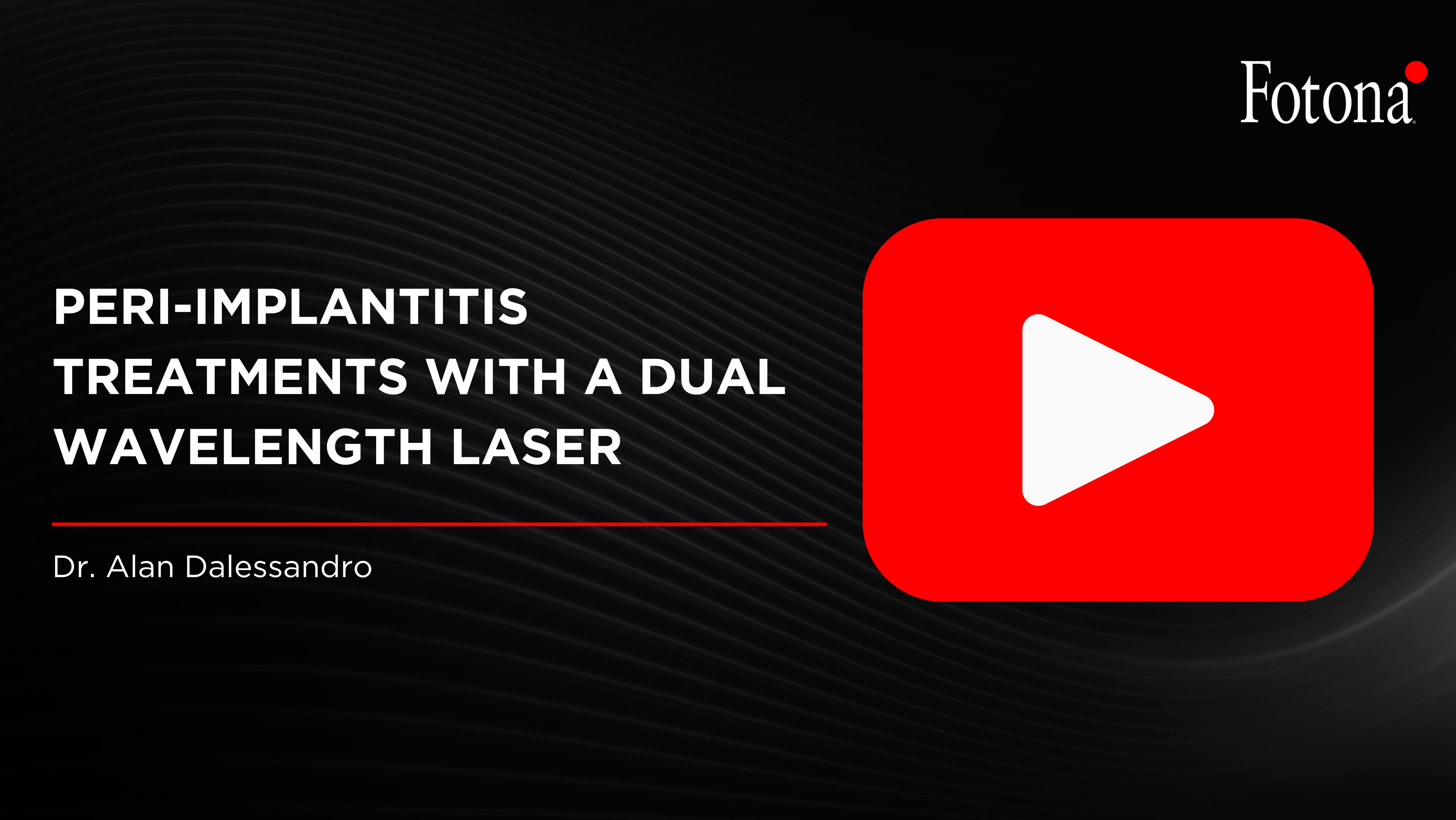 Peri-Implantitis Treatments with a Dual Wavelength Laser